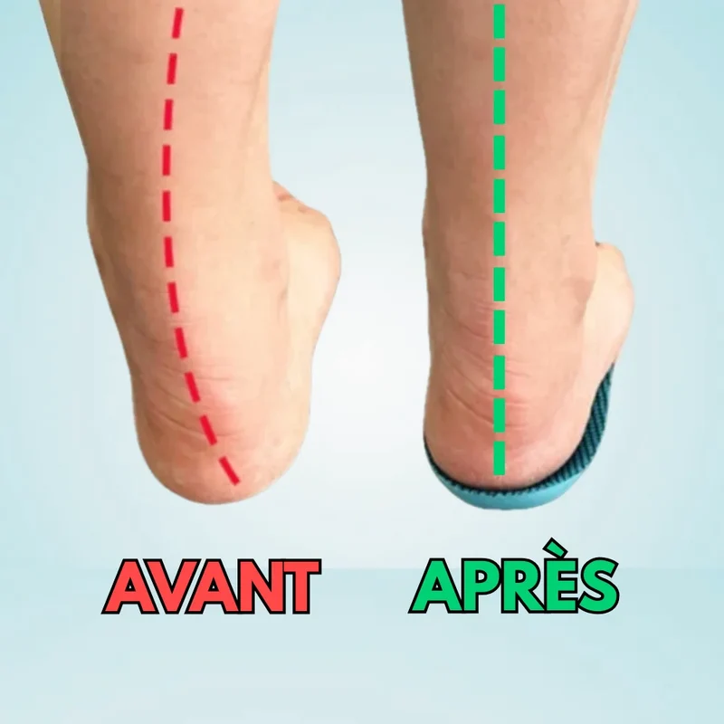 Semelles pour fasciite plantaire - Plus de douleur aux pieds en 14 jours | ConfortFlex®